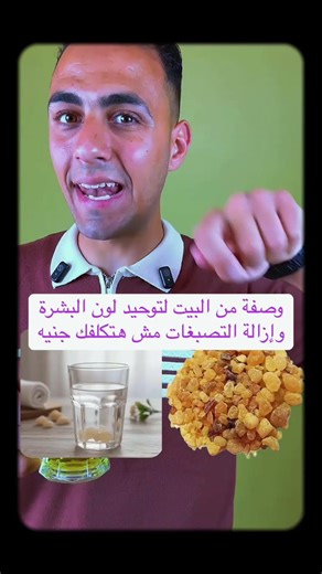 (وصفة هتخلصك من التصبغات وتوحد لون البشرة) | وصفة لبان الدكر💖#health #لبان_الذكر #healthylifestyle