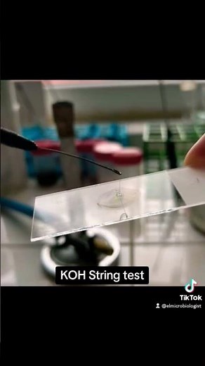 KOH String test (Alternative method to Gram stain) isolation of bacteria #Microbiology