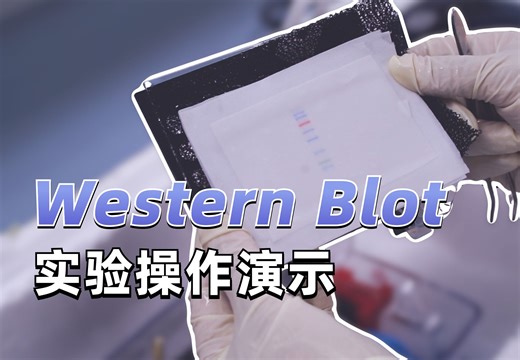 【科研实验】WB实验操作详解，手把手教你跑出完美蛋白条带图！ Western Blot