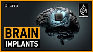 What does the future hold for brain implant technology? | The Stream - The Global Herald