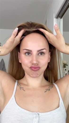 Alex Youmazzo on Instagram: "let’s talk alopeciaaa🫶🫶"