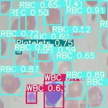 Blood Cells Detection with YOLOV5