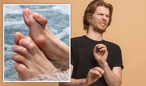 Hammertoe: Prevent the foot deformity with four movements