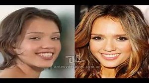 27 reactions | Celebrities teeth, before and after  | Cosmodent Ishtar Center | Facebook