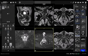 7.7K views · 149 reactions | MRI of Prostate filming & sequences...