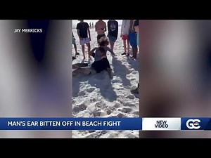 Teen accused of biting victim's ear off during fight on Fort Myers Beach