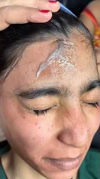 Full growth forehead hair Waxing by gel base Liposoluble Wax/ #waxing #Gelwax #skincare #beauty #wax