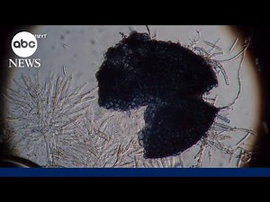 2 Chinese nationals charged with smuggling dangerous fungus into US