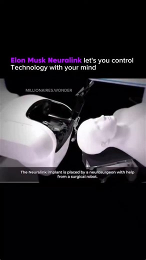 Business | Entrepreneurship | Inspiration on Instagram: "Follow to join the community of @millionaires.wonder Neuralink has begun its first human brain implant trials, combining robotics, AI, and neuroscience to connect the human brain directly to machines. A fully autonomous surgical robot places ultra-thin threads, thinner than human hair, into the brain’s motor cortex while avoiding blood vessels. The implant uses over 1,000 electrodes across flexible threads and sits invisibly beneath the sk