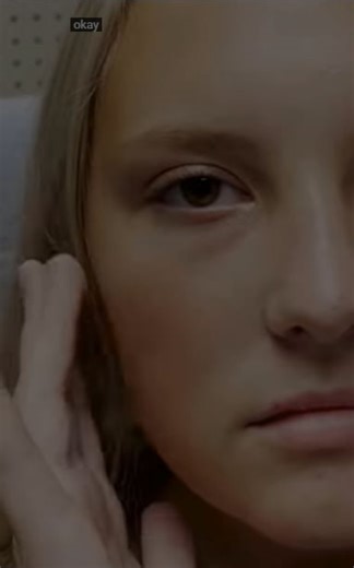 Chvostek sign Larry Mellick