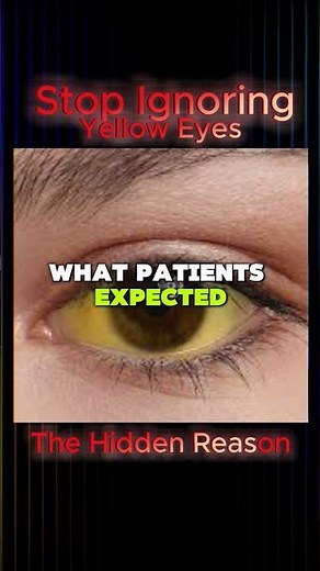 Why Are Your Eyes Turning Yellow? Don't Ignore This Sign ll Dr Allden