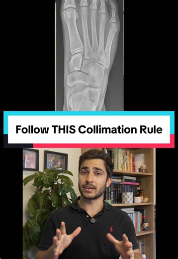 Essential Collimation Tips for Radiographers