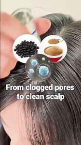 Stronger Hair Starts Here ✅ MTS Scalp Booster Treatment Explained