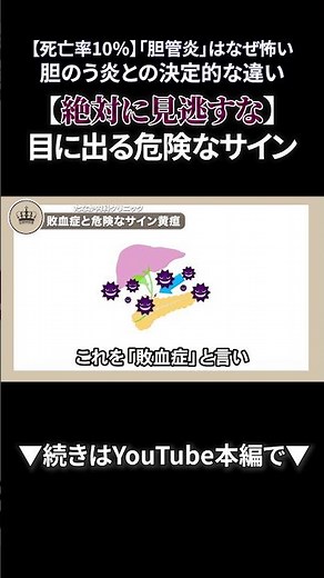 47 【死亡率10%】「胆管炎」はなぜ怖い？胆のう炎との決定的な違い②｜【胃腸と内視鏡の専門チャンネル】たなか内科クリニック #shorts