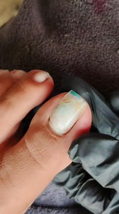 Fakenails removal and cleaning toenail #foryou #reelsvideo | Juvil Loz