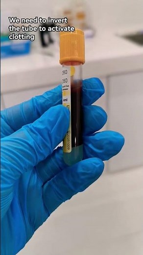 Serum Separating Tubes SST tube #laboratory #medtechstudent #cls #mls #blood #phlebotomy #evacuated