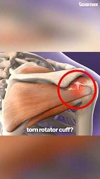 Your Rotator Cuff Is Torn — Here's What to Do Before Considering Surgery