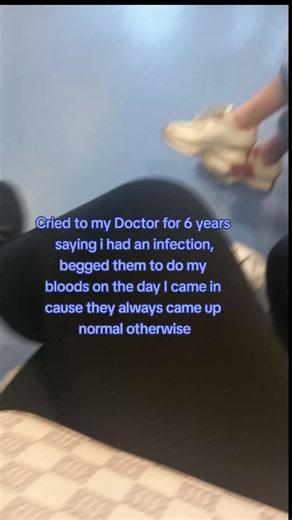 Proved ya wrong 😅 Turned out i needed my gallbladder removed, getting cholecystitis once a month for 6 years with no antibiotics... But to be fair the infection was only coming once a month & it was so hard to catch unless bloods were done on the day, I still like him but I am thinking now he was the one with psychosis. 🫠 #crazygirl #psychosis