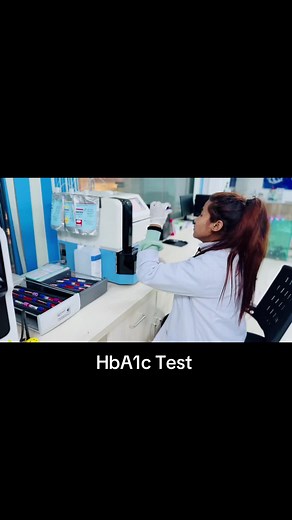 HbA1c Test by Gold Standard Method: HPLC Explained
