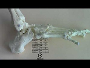 Cuboid Syndrome Hesch Interpretation