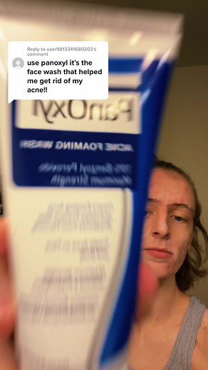 Panoxyl Acne Wash for Cystic Acne: Before & After Results