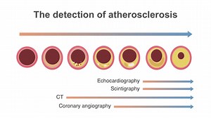 Learn how to perform coronary artery scoring (CAC) for your high-risk cardiac patients. Check out the rest of the Cardiac CT Essentials course: https://www.medmastery.com/course/cardiac-ct-essentials | Medmastery