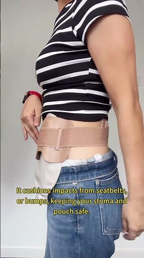 Bumps,Leakage—ostomy fears?😣Heagi Stoma Shield has your back—literally.#ostomy #ostomate #ostomybag