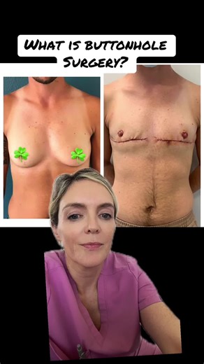 Understanding Buttonhole Surgery: Benefits and Risks