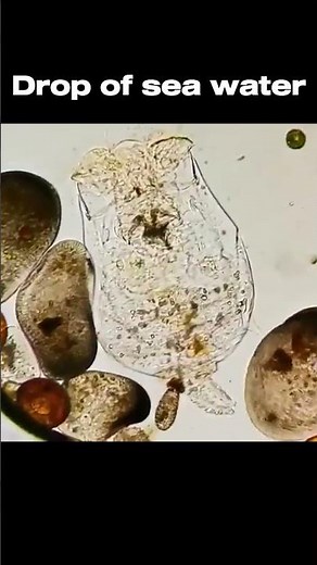 Life under a microscope.