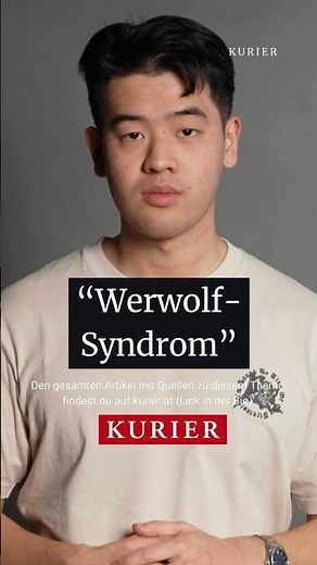 "Werwolf-Syndrom" bei Hunden #international #hunde #werwolf #werwolfsyndrom #deutschland #finnland