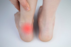 Comment soigner une tendinite du tendon d'Achille (calcanéenne) ?