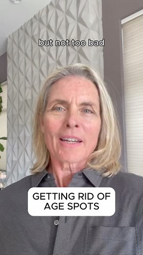 Looking to fade age spots? 🌞 There are multiple ways to reduce them, including prescription creams, medical treatments like IPL, laser therapy, and chemical peels, or over-the-counter options like glycolic acid. Some treatments take longer to heal than others, and sun protection is key to keeping them from coming back! ☀️ #Skincare #AgelessBeauty #Hyperpigmentation #IPL #SelfCare #KimAlexis | Kim Alexis