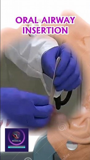 Oral Airway Insertion Procedure