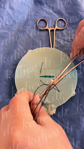 Mastering Suturing Techniques in Surgery