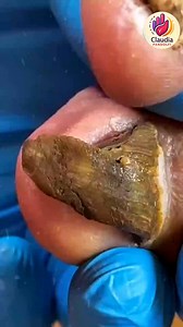 Ep.954 Weekly prep mindful breaks for calorie awareness 💐🎀 #CalorieControl #HeartHealthyDiet #WellnessRoutine | Claudia Pandolfi