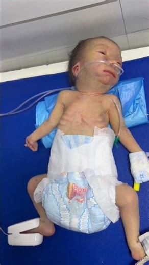 29 Weeks Premature Baby | A Story of Hope & Strength