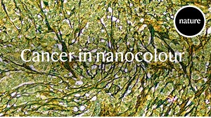 14K views · 304 reactions | Researchers are presenting a new type of microscope slide that uses nanotechnology to change the perceived colour of cells without staining them. They say that this could help diagnose diseases like cancer. Read the Nature paper: https://go.nature.com/3vpgTIR | Nature Portfolio | Facebook