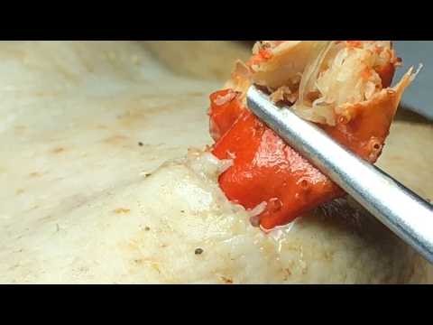 𝑺𝒌𝒊𝒏𝒄𝒂𝒓𝒆 𝑺𝒐𝒐𝒕𝒉𝒊𝒏𝒈 𝑬𝒙𝒕𝒓𝒆𝒎𝒆 𝑨𝒄𝒏𝒆 𝑷𝒐𝒑𝒑𝒊𝒏𝒈 𝑭𝒐𝒓 𝑺𝒕𝒓𝒆𝒔𝒔 𝑹𝒆𝒍𝒊𝒆𝒇𝒇 𝑺𝒂𝒕𝒊𝒔𝒇𝒚𝒊𝒏𝒈 𝑹𝒆𝒍𝒂𝒙𝒊𝒏𝒈 #7948