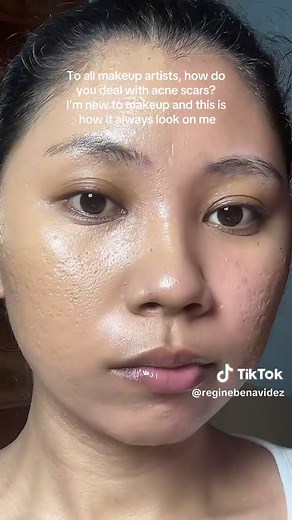 I used an elf primer and a foundation balm here #texturedskin #acnescars #makeupontexturedskin #unfiltered