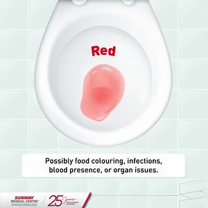 20K views · 355 reactions | Urine: Your Body’s Natural Health Report  Learn about the clues your body provides with every flush. From clear to concentrated, your pee holds the key to your well-being. If you notice irregularities in your urine, make an appointment with our Urologist -https://wa.link/s9rywn #SunwayMedicalCentre #WePrioritiseYourHealth #UrineColor | Sunway Medical Centre | Facebook