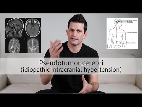Pseudotumor cerebri (idiopathic intracranial hypertension)