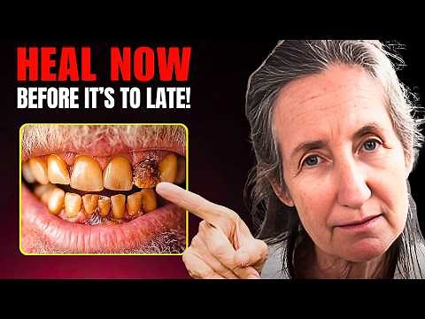How To Reverse a Cavity & Heal Teeth At Home | Barbara O'Neill