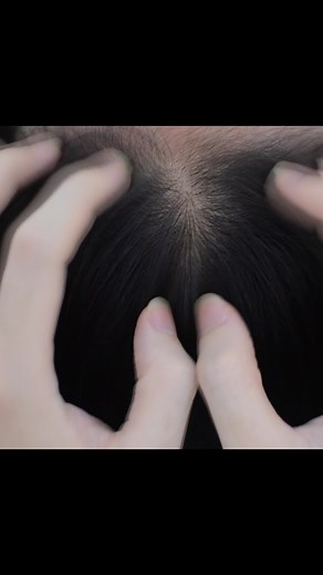 Asmr Scalp Scratching #asmr #scalpscratching