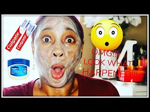 I APPLIED COLGATE TOOTHPASTE & VASELINE PETROLEUM JELLY ON MY FACE | LOOK WHAT HAPPENED!!! 😮