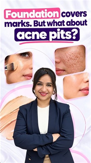 Foundation can cover acne marks, but what about acne pits? 👀