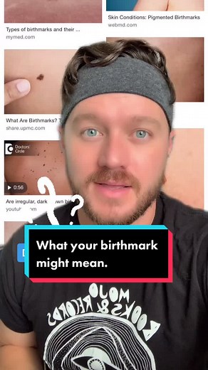 Decoding the Meaning Behind Your Birthmark