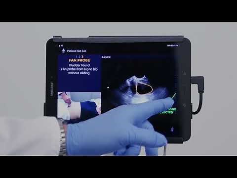 Determining Bladder Volume with EchoNous Bladder