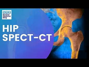 Nuclear Medicine | Bone SPECT-CT | Hips