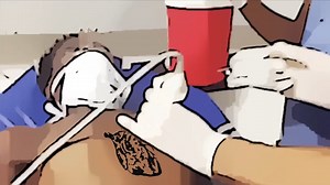 How to Perform a Pericardiocentesis_A Parasternal Approach