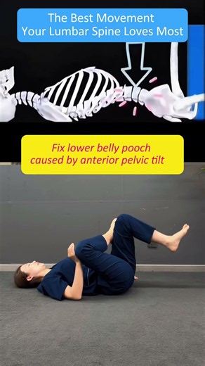Fix Anterior Pelvic Tilt and Reduce Belly Pooch With This Easy Home Exercise